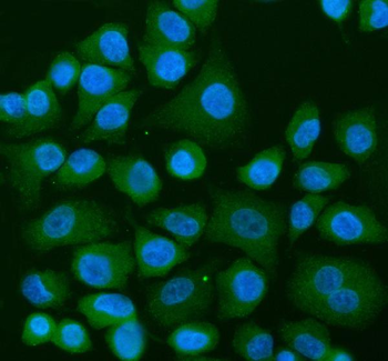 Anti-USP9X Antibody