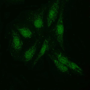 Anti-KIAA1429/VIRMA Antibody