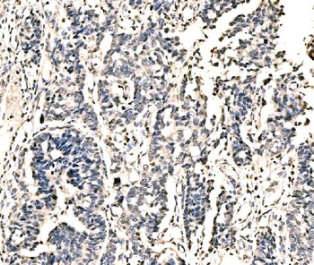 KIAA1429/VIRMA Antibody
