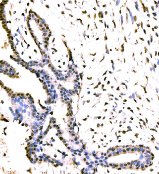 Anti-KIAA1429/VIRMA Antibody