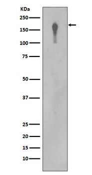 EGFR Rabbit Monoclonal Antibody