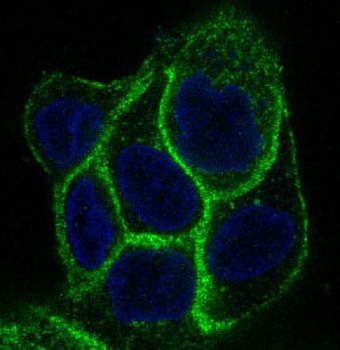 EGFR Rabbit Monoclonal Antibody
