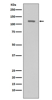 TERT Rabbit Monoclonal Antibody