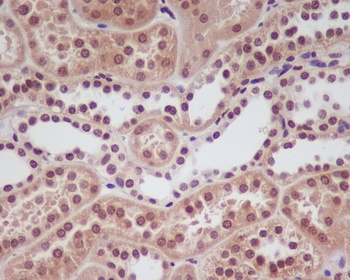 HIF-1 alpha/HIF Rabbit Monoclonal Antibody
