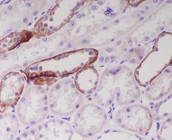 JAG1 Rabbit Monoclonal Antibody