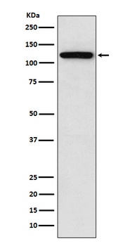 Sortilin Rabbit Monoclonal Antibody