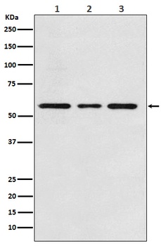 ACVRL1 Rabbit Monoclonal Antibody
