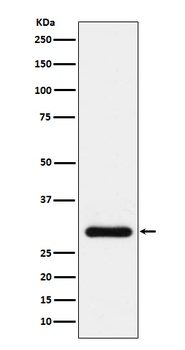BNP Rabbit Monoclonal Antibody