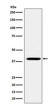 FOLR1 Rabbit Monoclonal Antibody