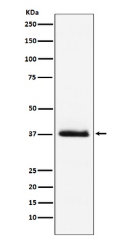 Parathyroid Hormone Rabbit Monoclonal Antibody