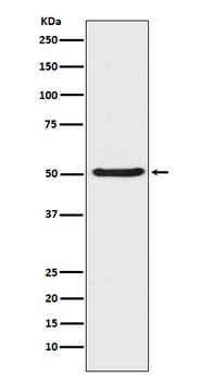 Angiopoietin 2 Rabbit Monoclonal Antibody