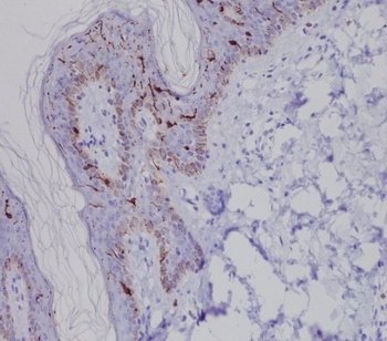 Langerin Rabbit Monoclonal Antibody