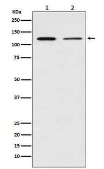 NFkB p100/p52 Rabbit Monoclonal Antibody