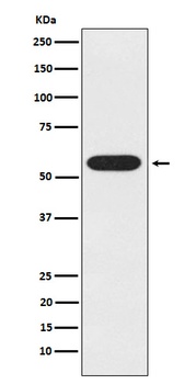 UAP1 Rabbit Monoclonal Antibody