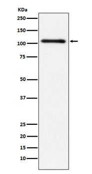 Protein Kinase D2 Rabbit Monoclonal Antibody