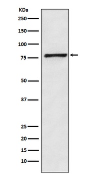 Fructose 6 Phosphate Kinase Rabbit Monoclonal Antibody