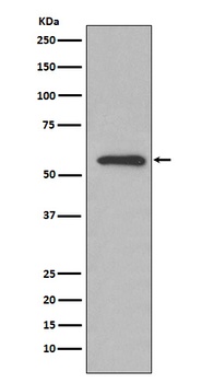 Glucose 6 phosphate isomerase Rabbit Monoclonal Antibody