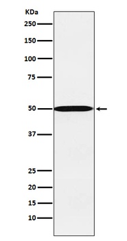 CYP26A1 Rabbit Monoclonal Antibody