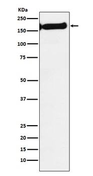 SF3B1 Rabbit Monoclonal Antibody