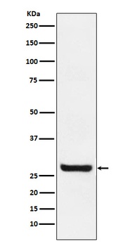 Sprouty 4 Rabbit Monoclonal Antibody