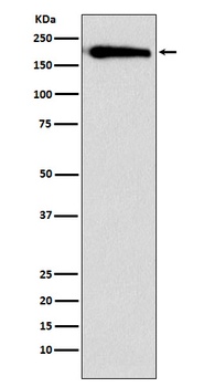 SMARCC1/BAF155 Rabbit Monoclonal Antibody