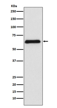 PARP2 Rabbit Monoclonal Antibody
