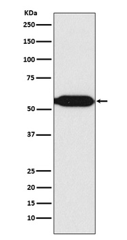 MEF2C Rabbit Monoclonal Antibody