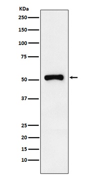 Retinoic Acid Receptor gamma Rabbit Monoclonal Antibody