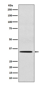 SULT2A1 Rabbit Monoclonal Antibody