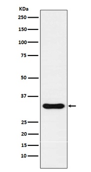 NKX3.1 Rabbit Monoclonal Antibody