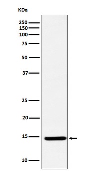 CDKN2A/p14ARF Rabbit Monoclonal Antibody