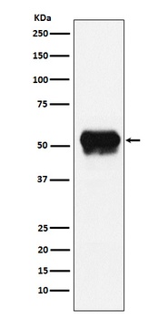 Fibrinogen gamma chain Rabbit Monoclonal Antibody