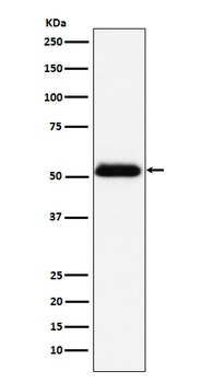 Prostatic Acid Phosphatase Rabbit Monoclonal Antibody
