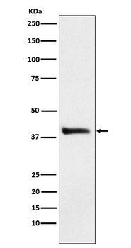 Alcohol Dehydrogenase Rabbit Monoclonal Antibody
