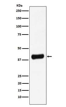 Galectin 8 Rabbit Monoclonal Antibody