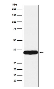 Tropomyosin 1 Rabbit Monoclonal Antibody