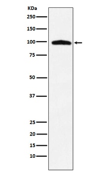 TNPO3 Rabbit Monoclonal Antibody