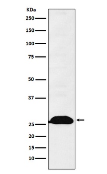 Kappa Chain Rabbit Monoclonal Antibody