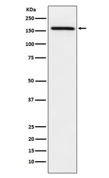 ADAMTS13 Rabbit Monoclonal Antibody