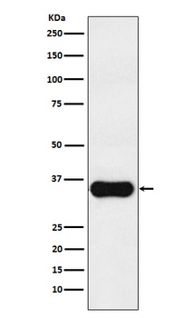 MC1 Receptor Rabbit Monoclonal Antibody