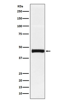 Pentraxin 3 Rabbit Monoclonal Antibody