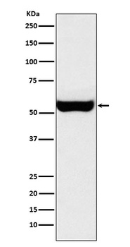 Monoamine Oxidase B Rabbit Monoclonal Antibody