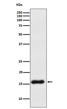 VAMP1 Rabbit Monoclonal Antibody