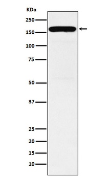 DIAPH1 Rabbit Monoclonal Antibody