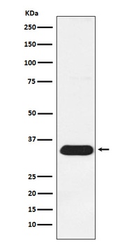 Syntenin Rabbit Monoclonal Antibody
