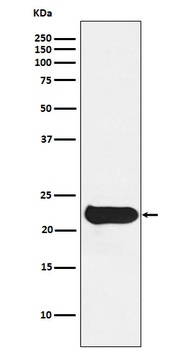 Glutathione Peroxidase 2 Rabbit Monoclonal Antibody (Peroxidase)