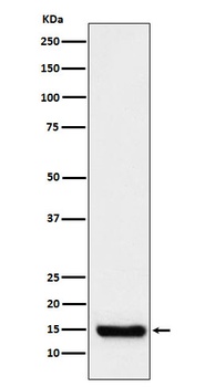 TTC11 Rabbit Monoclonal Antibody