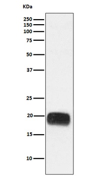Mammaglobin A Rabbit Monoclonal Antibody