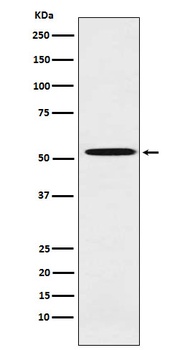 ALDH1A2 Rabbit Monoclonal Antibody