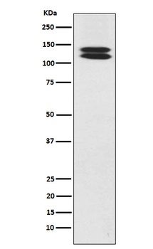 H Cadherin Rabbit Monoclonal Antibody